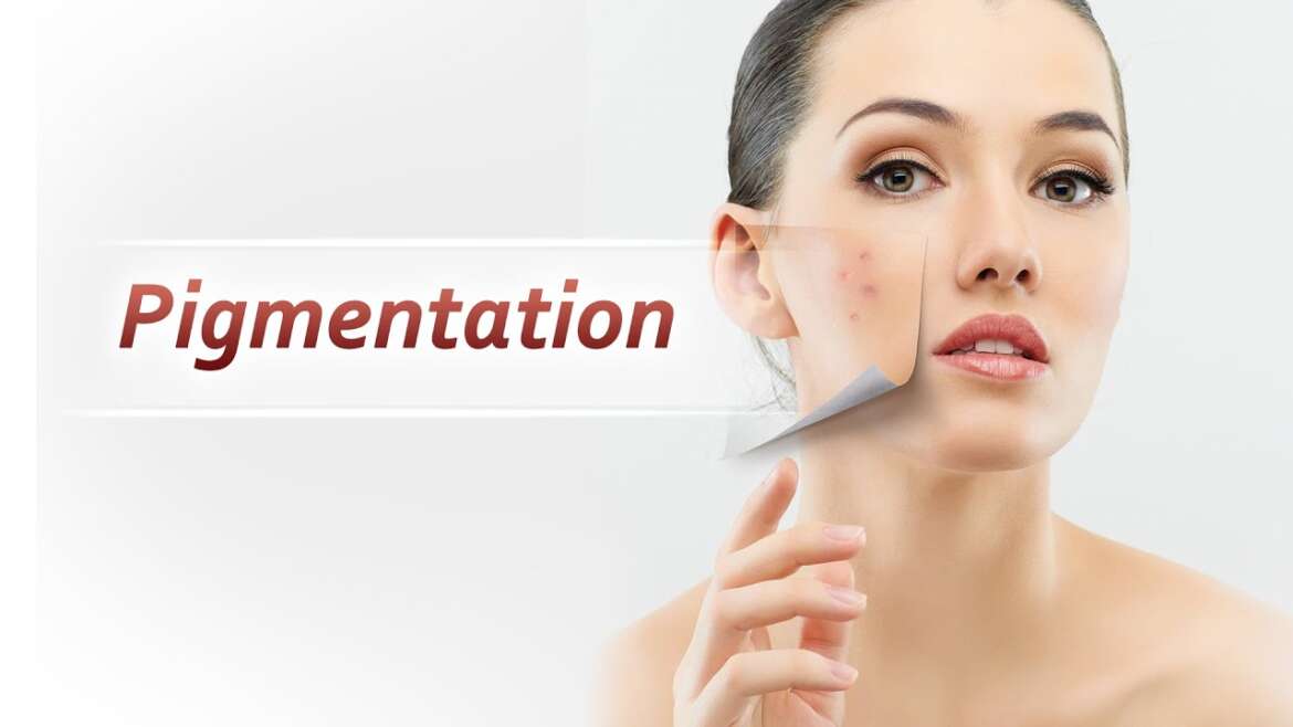 Skin Hyperpigmentation