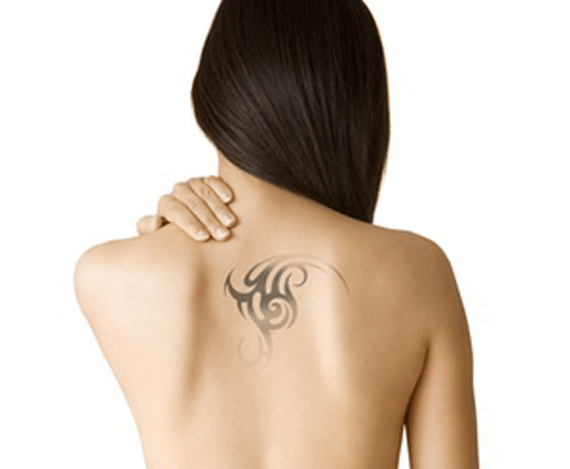 tattoo removal treatment in delhi