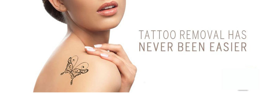 Laser Tattoo Removal 